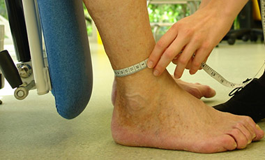 Measurement of ankle circumference